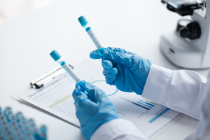 Анализ на наличие алкоголя